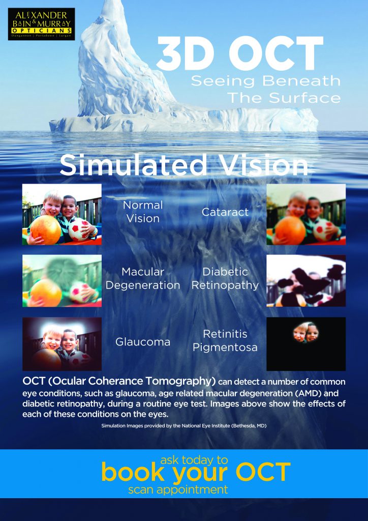 Simulated Vision